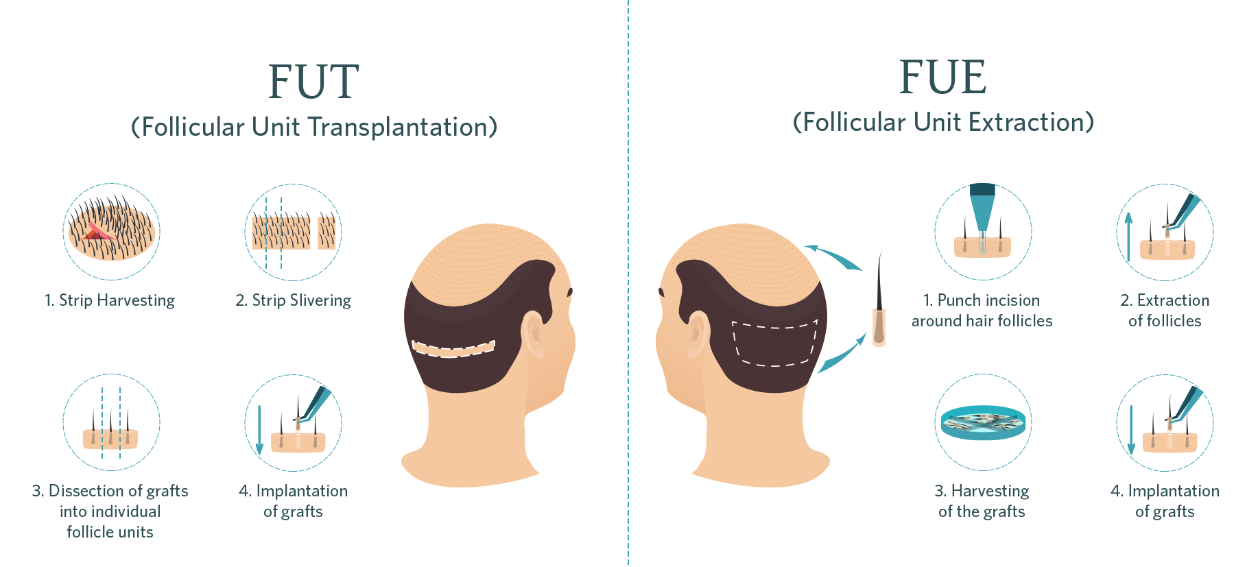 treatment_surgical_hairrestoration.png
