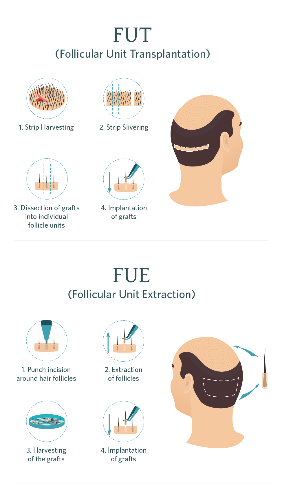 treatment_surgical_hairrestoration_mob.png