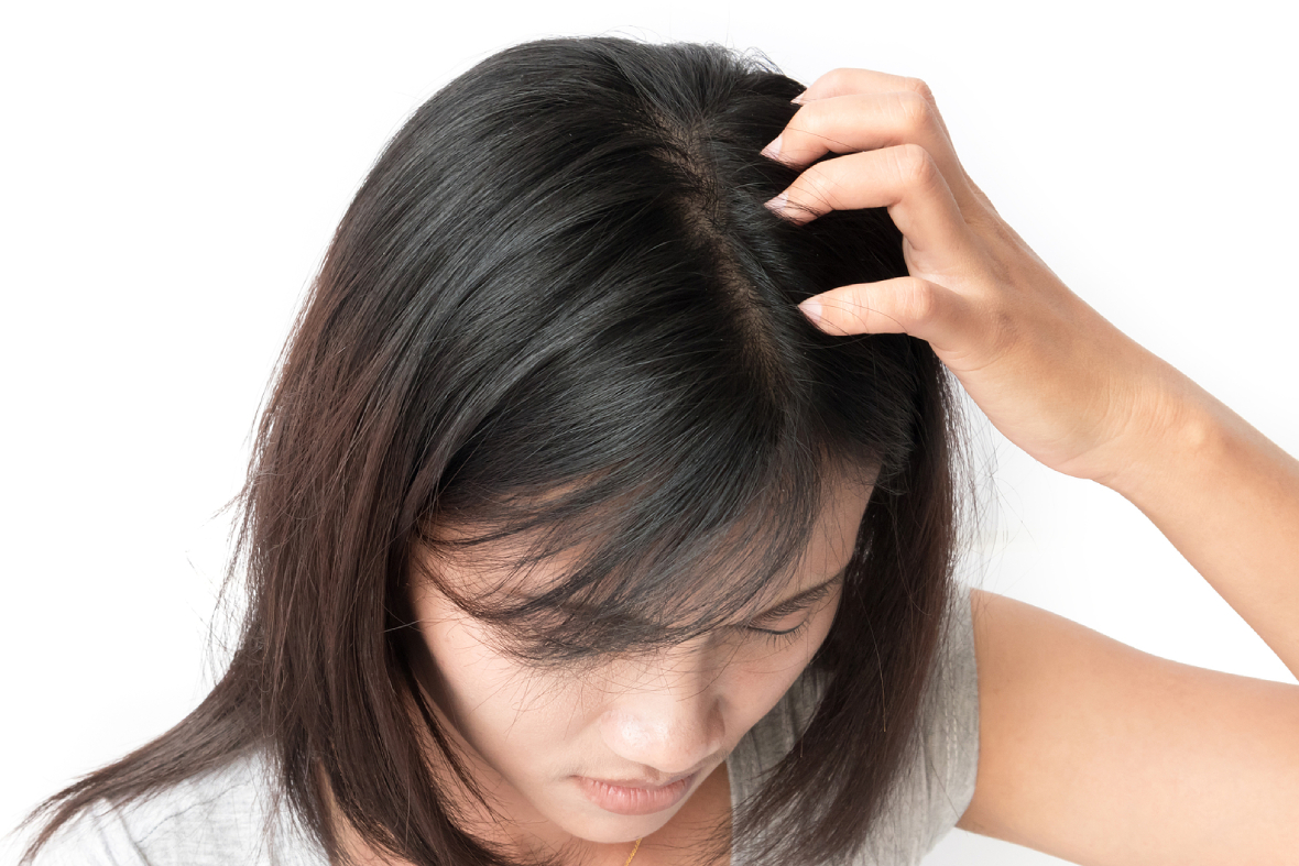 Dandruff: What is It And When You Should See a Dermatologist?