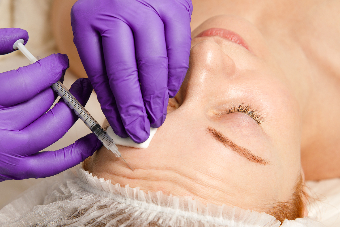 Dermal Fillers: What Exactly Are They And What To Expect?