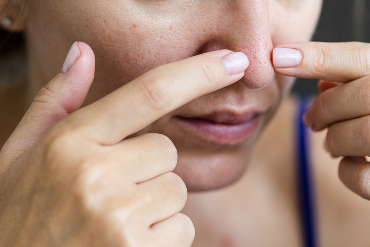 5 Things You Can Do To Minimise Large, Visible Pores
