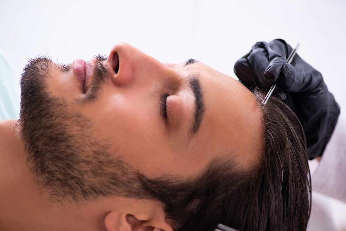 The Science Behind Hair Growth: How Do Transplants Work?