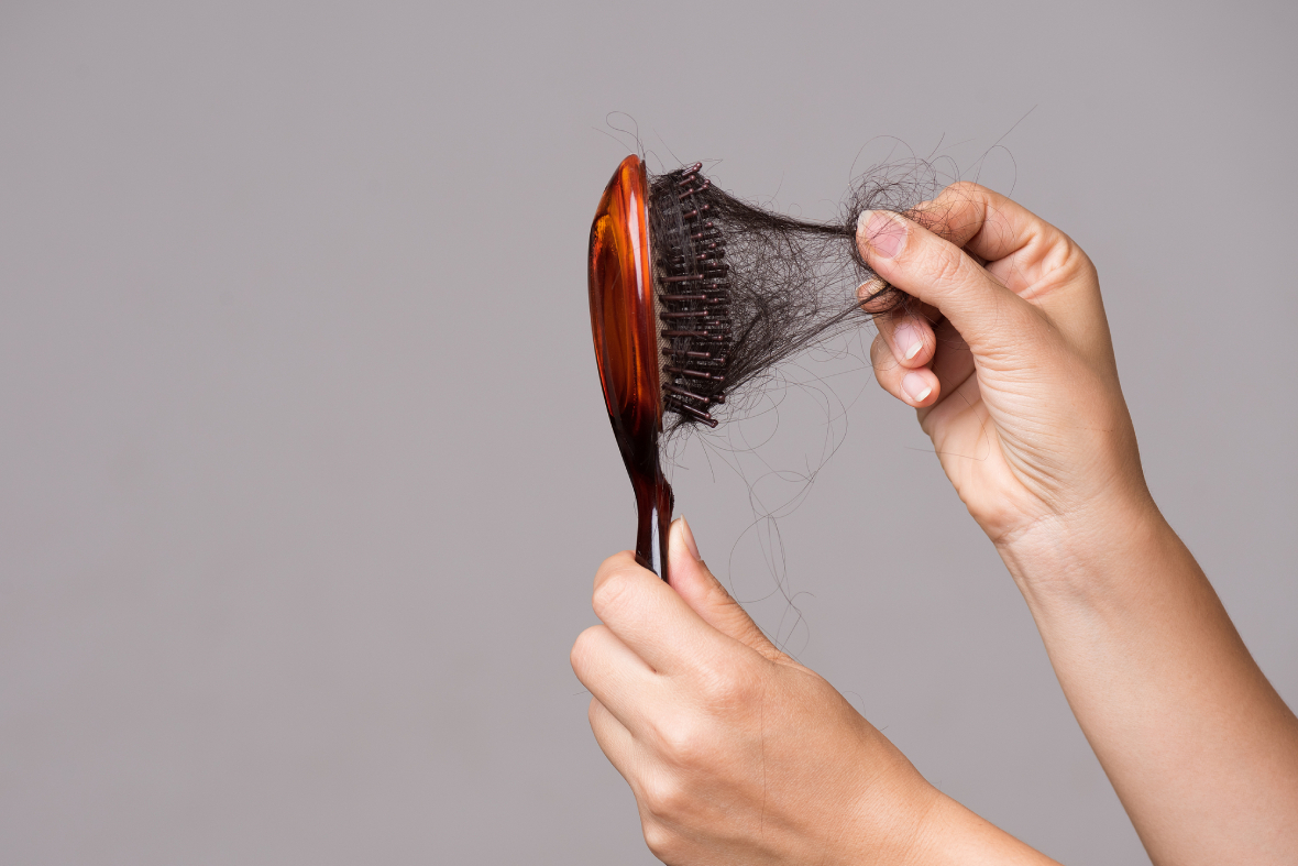 Why Choose FUE Hair Transplant For Hair Restoration?