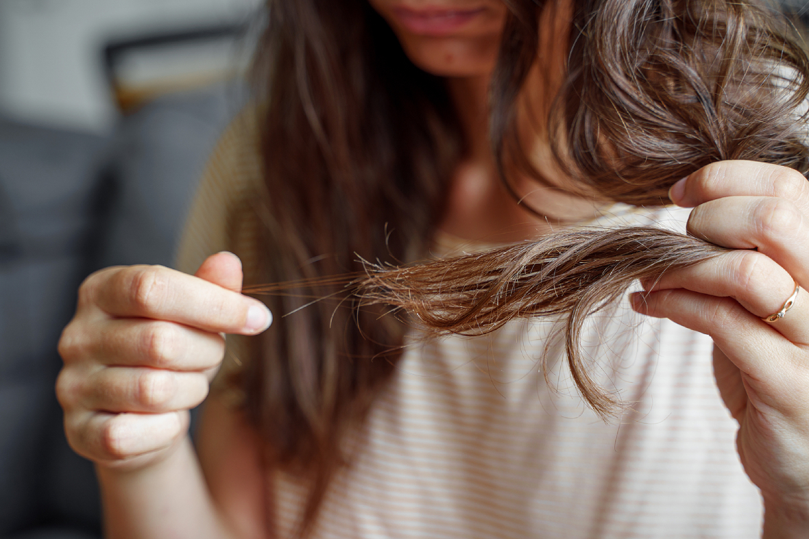 Hair Thinning Or Falling Out? What To Do & Who To See