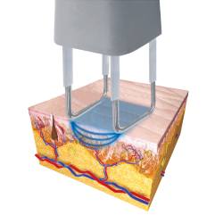 FCO2 Scanner