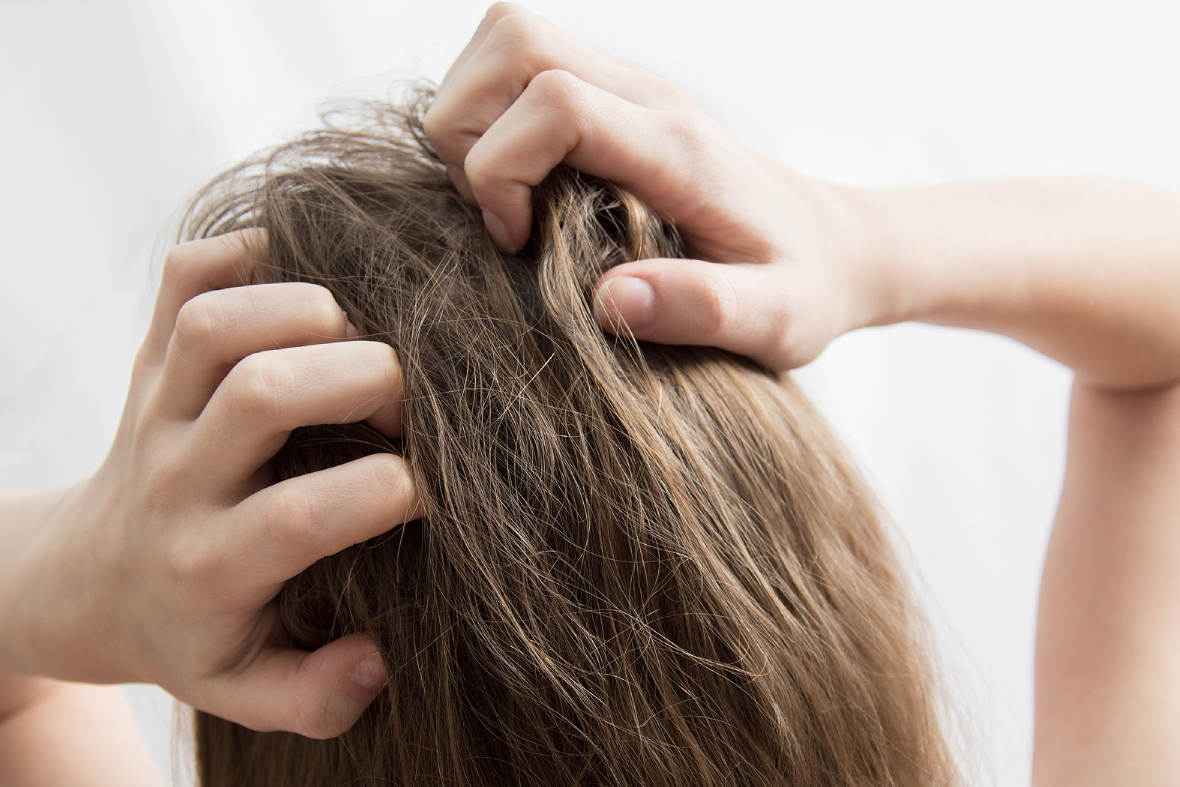 Why Does My Scalp Smell? 6 Medical Causes You Shouldn’t Ignore