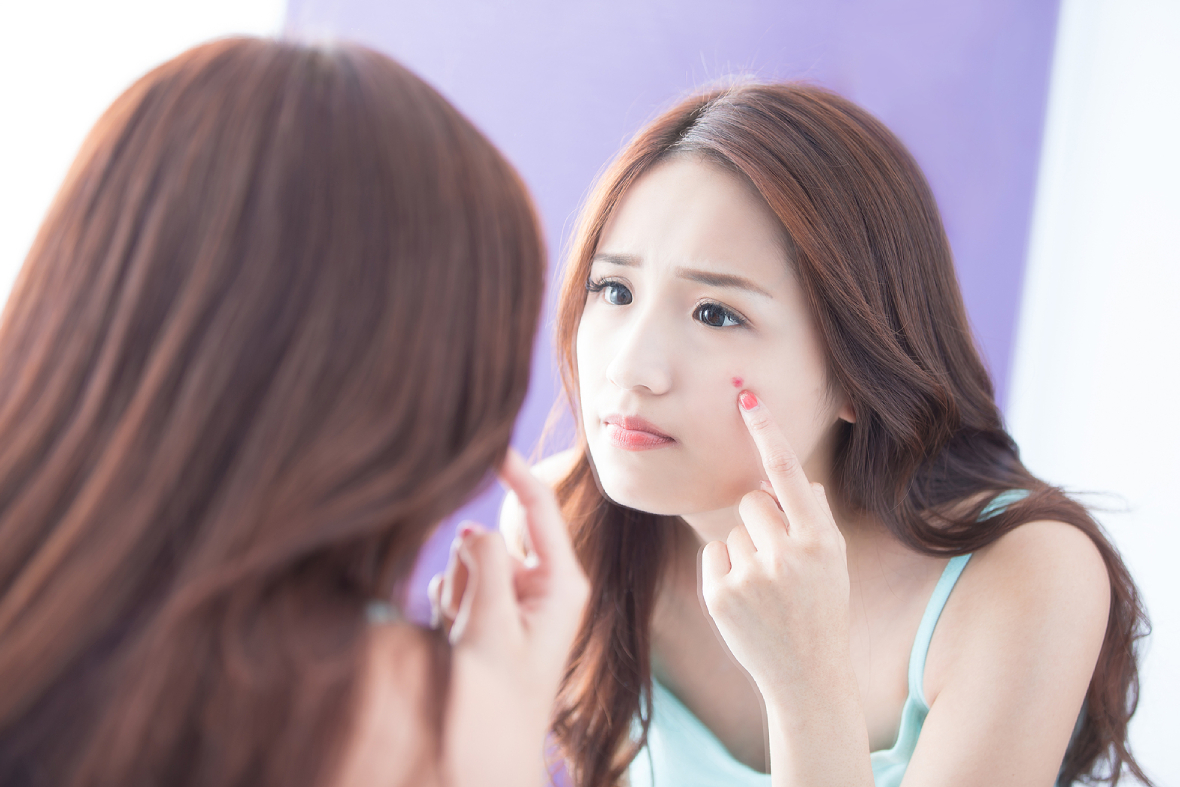 Not All Acne Is the Same! Which One Do You Really Have?