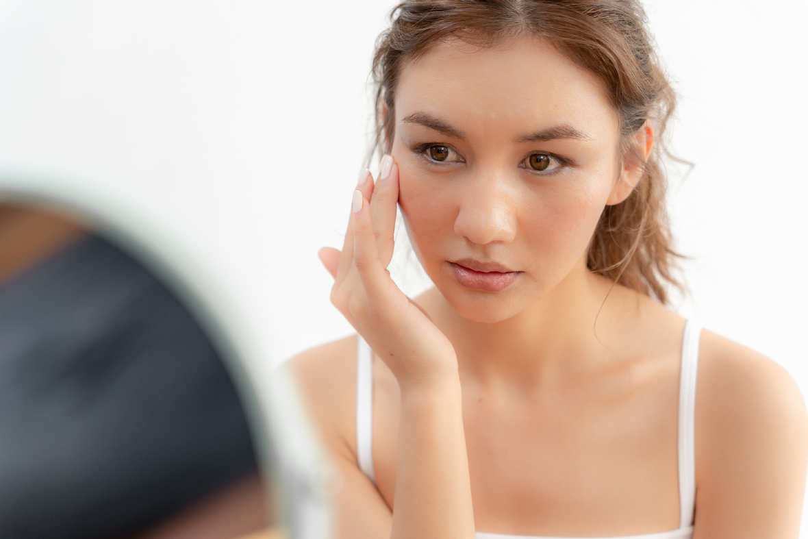 Rosacea In Asian Skin: Why It’s Often Misdiagnosed