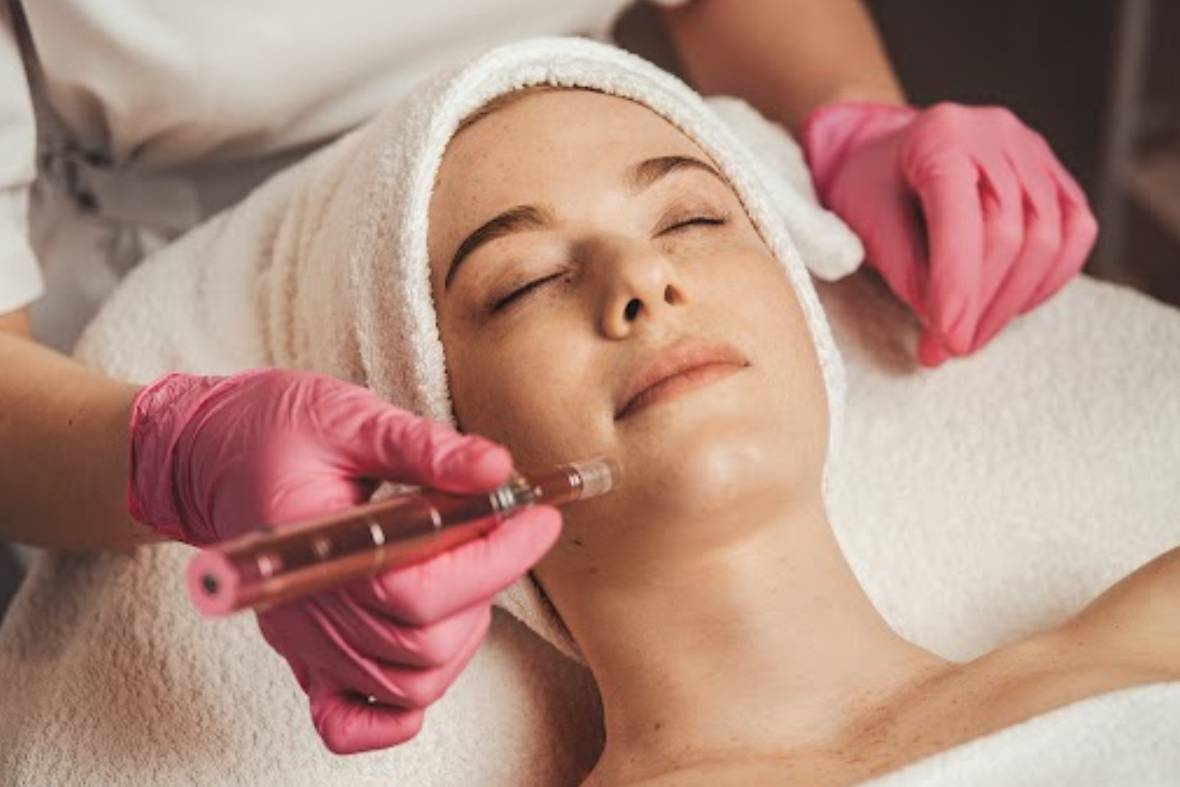 Why At-Home Microneedling Isn’t Like In-Clinic Treatments