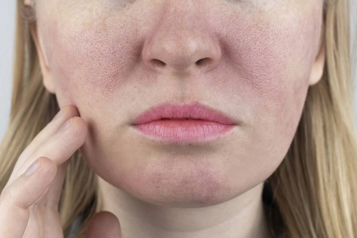 Can Pores Actually Shrink? The Truth Behind Pore Myths