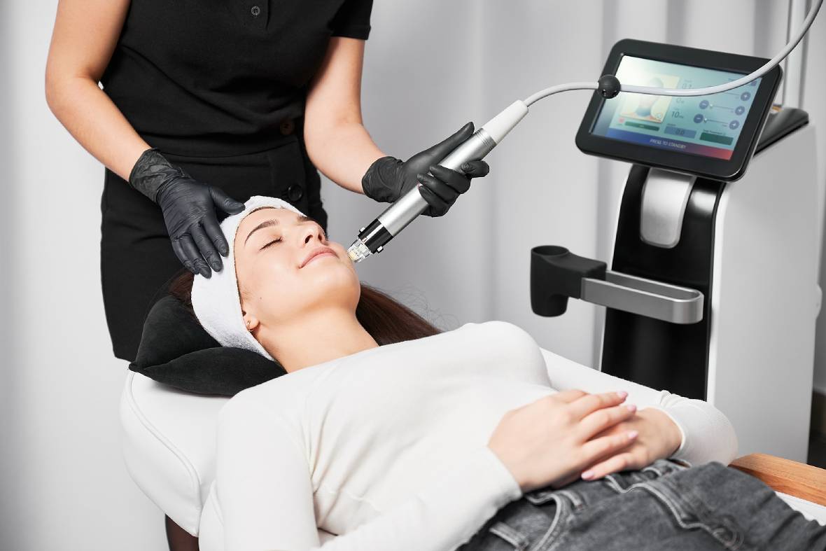 Fractional RF Microneedling Technology Vs Traditional RF Treatments: What Sets Them Apart?